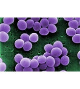 人喉癌细胞；Hep-2 NS2