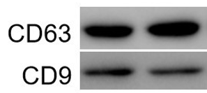 1617175642941515.png 8 外泌体标志物鉴定 外泌体Western blot鉴定服务.png